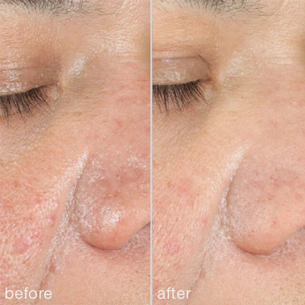 PowerBright Dark Spot Peel - Afbeelding 5