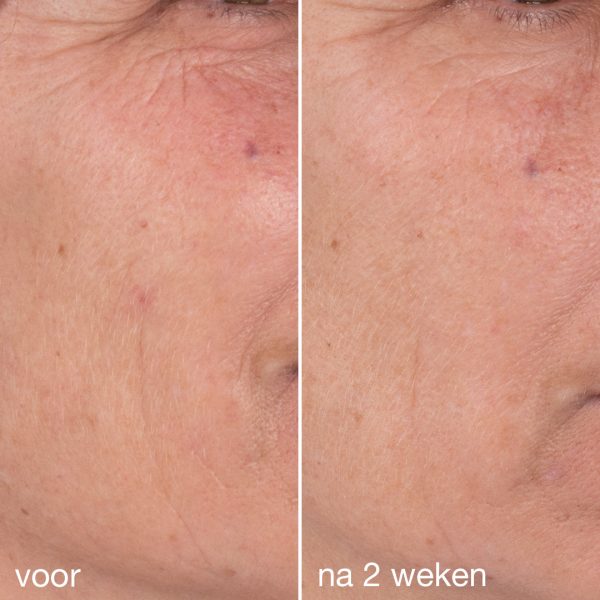 Dynamic Skin Retinol Serum - Afbeelding 4