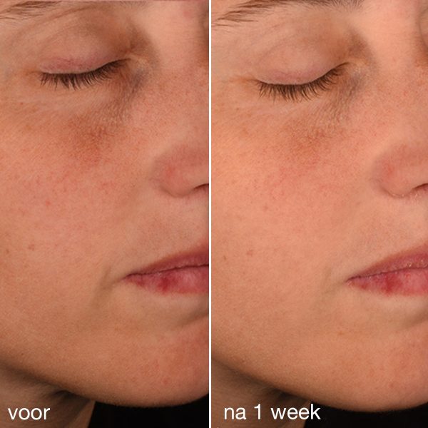 Pro-Collagen Banking Serum - Afbeelding 5